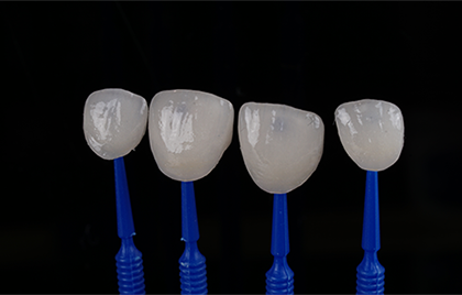 Zirconia E-Max