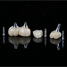 Screw Retained